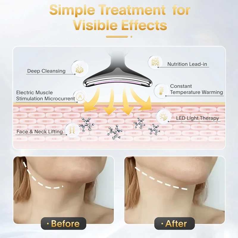 Anti Aging, Anti Wrinkles Skin Tightening Massager (Imported)