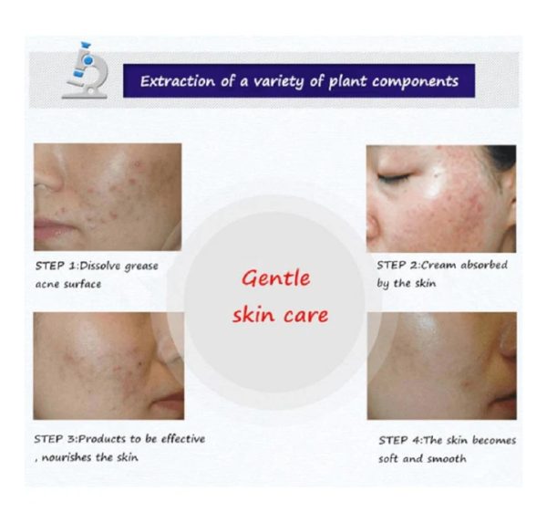 BIOAQUA Acne Cleanser