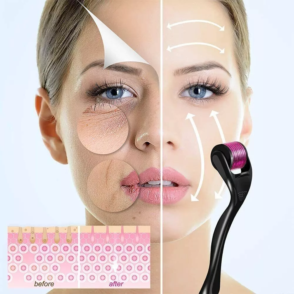540 Titanium Derma Roller